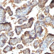 FFPE human placenta sections stained with 100 ul anti-Galectin-13 (clone PP13/1164) at 1:50. HIER epitope retrieval prior to staining was performed in 10mM Citrate, pH 6.0 or 10mM Tris 1mM EDTA, pH 9.0.